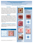 Prospective Assessment and Classification of Stoma Related Skin Disorders.pdf